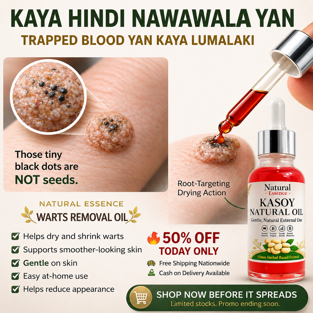 Kasoy Natural Oil