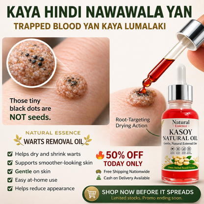 Kasoy Natural Oil